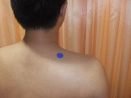 ������